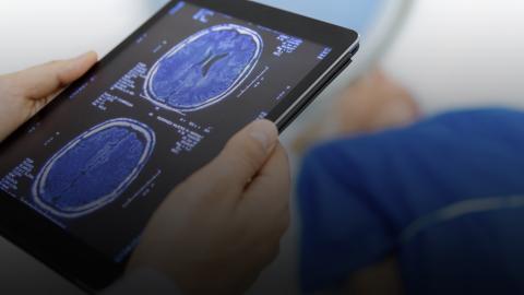  Technicien radiologique tenant le scanner cérébral d'un patient